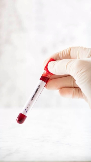 Blood Tests- Private at-home